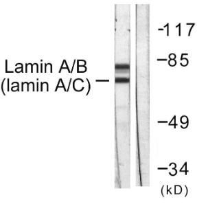 Anti-Lamin A and C antibody