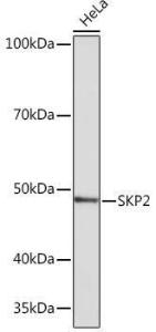 Western blot analysis of extracts of HeLa cells, using Anti-SKP2 Antibody [ARC0886] (A307422) at 1:1,000 dilution. The secondary antibody was Goat Anti-Rabbit IgG H&L Antibody (HRP) at 1:10,000 dilution.