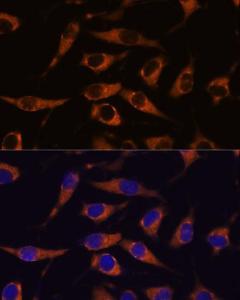 Immunofluorescence analysis of L929 cells using Anti-SMAP1 Antibody (A305769) at a dilution of 1:100 DAPI was used to stain the cell nuclei (blue)