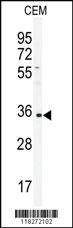 Anti-IGHA1 Rabbit Polyclonal Antibody