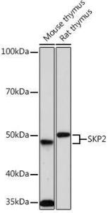 Western blot analysis of extracts of various cell lines, using Anti-SKP2 Antibody [ARC0886] (A307422) at 1:1,000 dilution. The secondary antibody was Goat Anti-Rabbit IgG H&L Antibody (HRP) at 1:10,000 dilution.