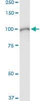 Anti-STAT1 Polyclonal Antibody Pair