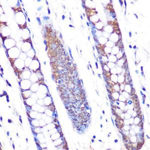 Immunohistochemistry analysis of paraffin-embedded human colon tissue using Anti-SKP2 Antibody [ARC0886] (A307422) at a dilution of 1:100 (40x lens). Perform microwave antigen retrieval with 10 mM PBS buffer pH 7.2 before commencing with IHC staining protocol.