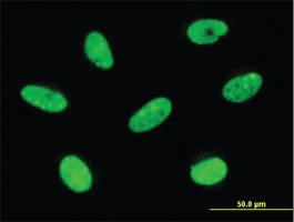 Anti-LBX2 Mouse Monoclonal Antibody [clone: 3A5]