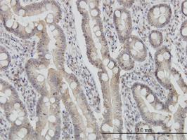 Anti-FIS1 Mouse Monoclonal Antibody [clone: 1G9]