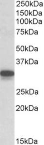 EB10695 (0.1 µg/ml) staining of Mouse Lung lysate (35 µg protein in RIPA buffer). Primary incubation was 1 hour. Detected by chemiluminescence.