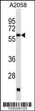 Anti-PDK3 Rabbit Polyclonal Antibody