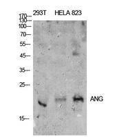 Western blot analysis of extracts from 293T, Hela, 823 cells using Anti-ANG Antibody