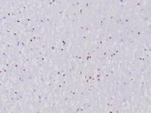 Immunohistochemical analysis of formalin-fixed, paraffin-embedded human cerebellum tissue using Anti-OLIG2 Antibody [OLIG2/6695R]