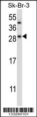 Anti-CHMP2B Rabbit Polyclonal Antibody