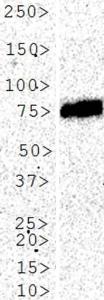 Anti-ALPP Mouse Monoclonal Antibody [clone: 8B6]