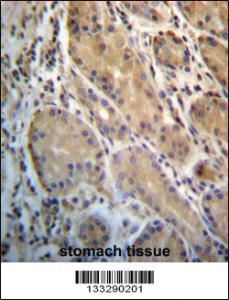 Anti-ERO1L Rabbit Polyclonal Antibody