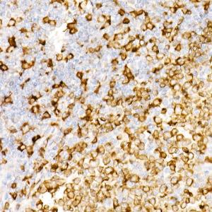 Immunohistochemistry analysis of paraffin-embedded human tonsil using Anti-CD74 Antibody [ARC1452] (A307423) at a dilution of 1:100 (40X lens). Perform high pressure antigen retrieval with 10 mM Tris/EDTA buffer pH 9.0 before commencing with IHC staining protocol