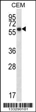 Anti-ERO1L Rabbit Polyclonal Antibody