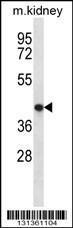 Anti-TNMD Rabbit Polyclonal Antibody