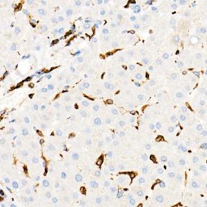 Immunohistochemistry analysis of paraffin-embedded human liver using Anti-CD74 Antibody [ARC1452] (A307423) at a dilution of 1:100 (40X lens). Perform high pressure antigen retrieval with 10 mM Tris/EDTA buffer pH 9.0 before commencing with IHC staining protocol