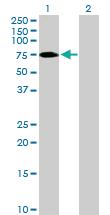 Anti-ZNF189 Mouse Polyclonal Antibody