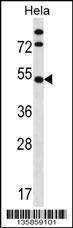 Anti-IP6K1 Rabbit Polyclonal Antibody (APC (Allophycocyanin))