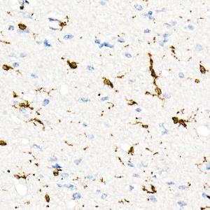 Immunohistochemistry analysis of paraffin-embedded human brain tissue using Anti-CD74 Antibody [ARC1452] (A307423) at a dilution of 1:100 (40X lens). Perform high pressure antigen retrieval with 10 mM Tris/EDTA buffer pH 9.0 before commencing with IHC staining protocol