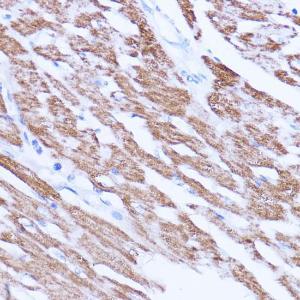 Immunohistochemistry analysis of paraffin-embedded rat heart using Anti-SIRT3 Antibody (A308368) at a dilution of 1:100 (40x lens) Perform microwave antigen retrieval with 10 mM PBS buffer pH 72 before commencing with IHC staining protocol