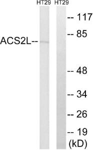 Western blot analysis of lysates from HT-29 cells using Anti-ACSS1 Antibody. The right hand lane represents a negative control, where the antibody is blocked by the immunising peptide.