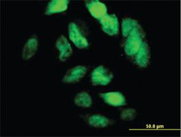 Anti-TCF12 Mouse Monoclonal Antibody [clone: 2E9]