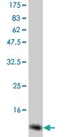 Anti-CSF2 Mouse Monoclonal Antibody [clone: 2G9]