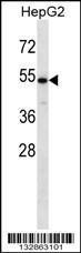 Anti-CHST9 Rabbit Polyclonal Antibody (AP (Alkaline Phosphatase))