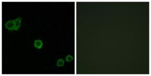 Immunofluorescence analysis of HeLa cells using Anti-CPI17 alpha Antibody. The right hand panel represents a negative control, where the antibody was pre-incubated with the immunising peptide