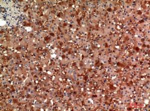 Immunohistochemical analysis of paraffin-embedded human liver using Anti-ANG Antibody