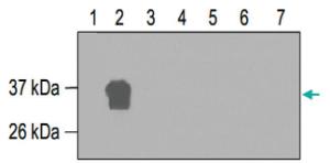 Anti-RUNX1T1 Polyclonal Antibody