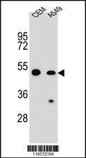 Anti-CARD16 Rabbit Polyclonal Antibody (PE (Phycoerythrin))