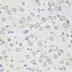 Immunohistochemistry analysis of paraffin-embedded rat brain using Donkey Anti-Goat IgG H&L Antibody (HRP) (A17357) at a dilution of 1:100 (40x lens). Perform microwave antigen retrieval with 10 mM PBS buffer pH 7.2 before commencing with IHC staining protocol.