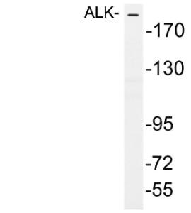 Western blot analysis of lysates from HepG2 cells using Anti-ALK Antibody
