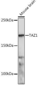 Western blot analysis of extracts of Mouse brain, using Anti-TOPAZ1 Antibody (A305771) at 1:1,000 dilution