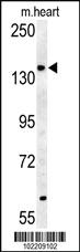 Anti-ABCB4 Rabbit Polyclonal Antibody