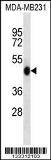 Anti-WIPI2 Rabbit Polyclonal Antibody