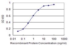 Anti-LBX2 Mouse Monoclonal Antibody [clone: 3A5]