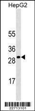 Anti-SOCS3 Mouse Monoclonal Antibody [clone: 532CT13.5.3]