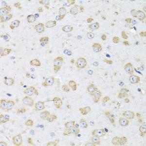 Immunohistochemistry analysis of paraffin-embedded mouse brain using Donkey Anti-Goat IgG H&L Antibody (HRP) (A17357) at a dilution of 1:100 (40x lens). Perform microwave antigen retrieval with 10 mM PBS buffer pH 7.2 before commencing with IHC staining protocol.