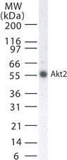 Anti-BRCA1 Mouse Monoclonal Antibody (DyLight® 550) [clone: KEN]