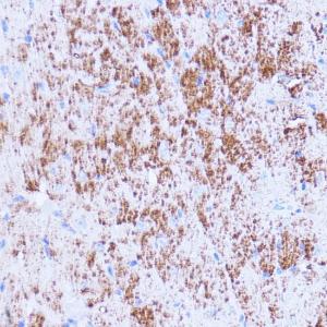 Immunohistochemistry analysis of paraffin-embedded mouse heart using Anti-SIRT3 Antibody (A308368) at a dilution of 1:100 (40x lens) Perform microwave antigen retrieval with 10 mM PBS buffer pH 72 before commencing with IHC staining protocol