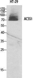 Western blot analysis of various cells using Anti-ACSS1 Antibody