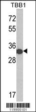 Anti-6X His tag Rabbit Polyclonal Antibody