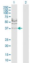 Anti-RAD51C Rabbit Polyclonal Antibody