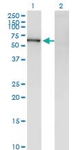 Anti-ZKSCAN8 Mouse Monoclonal Antibody [clone: 1F2]