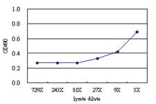 Anti-TFB1M Antibody Pair