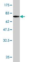 Anti-ERCC2 Mouse Monoclonal Antibody [clone: S3]