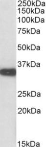 EB10714 (0.01 µg/ml) staining of Mouse Kidney lysate (35 µg protein in RIPA buffer). Primary incubation was 1 hour. Detected by chemiluminescence.