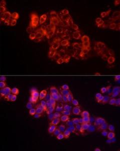 Immunofluorescence analysis of HepG2 cells using Donkey Anti-Goat IgG H&L Antibody (HRP) (A17357) at a dilution of 1:50 (40x lens). DAPI was used to stain the cell nuclei (blue).